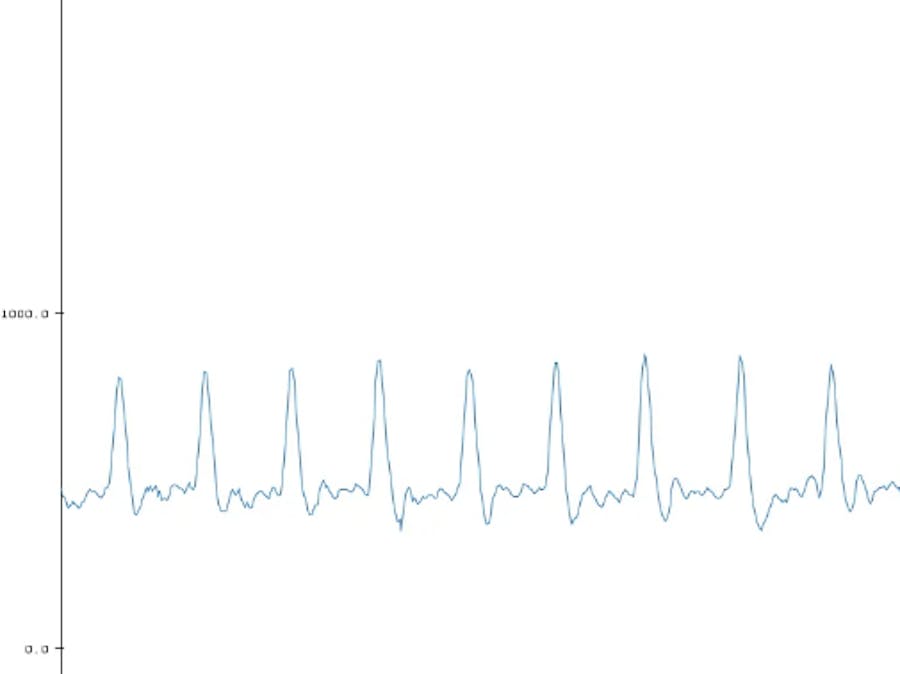 DIY Infrared Heart Beat Sensor using Arduino