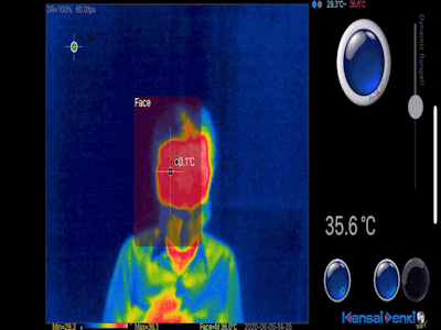Thermal Cam for COVID-19