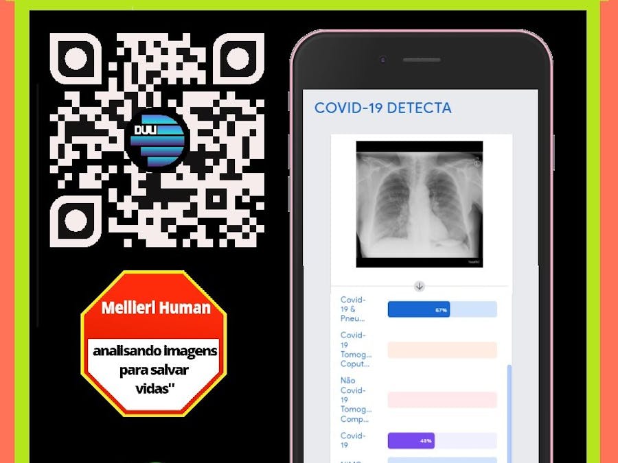 DULI Universal Image Injury Detector [COVID-19]
