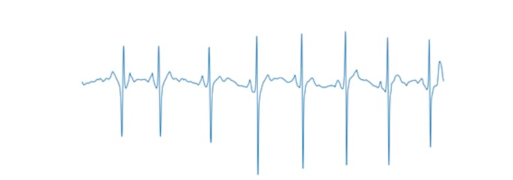 Figure 4, Axis-free ECG signal.