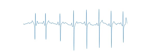 Figure 4, Axis-free ECG signal.