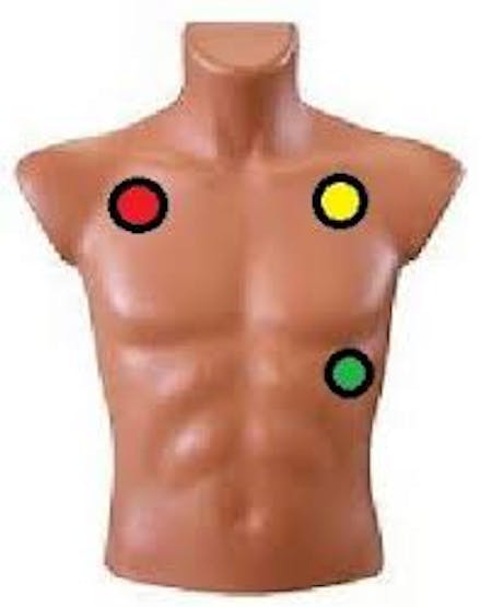 Figura 18. Three Leads ECG.