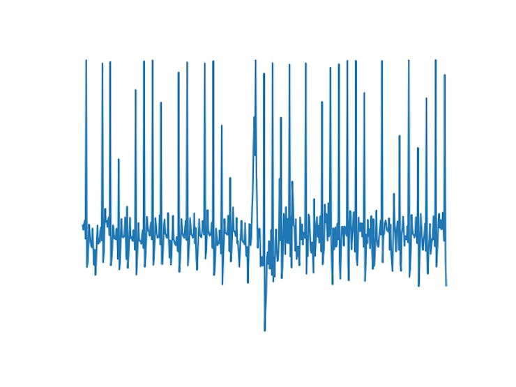 Figure 20. My ECG signal acquired by the robot.