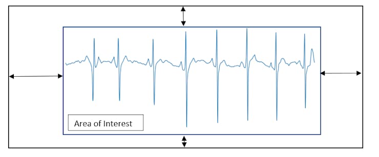 Figure 5, Extraction of the area of interest.