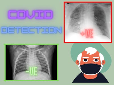 COVID-19 Detection from X-Ray Using OpenVino
