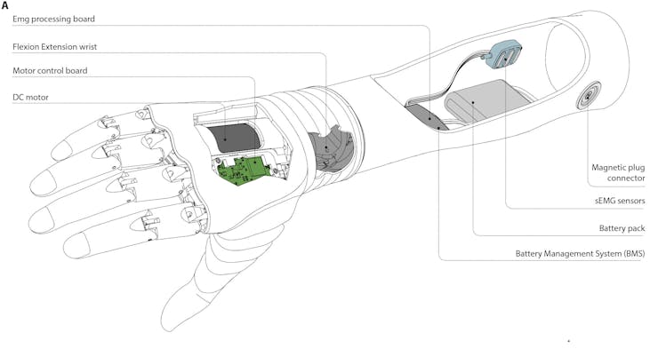 This New Robotic Prosthetic Hand Very Closely Mimics the Capability of Natural  Human Hands 