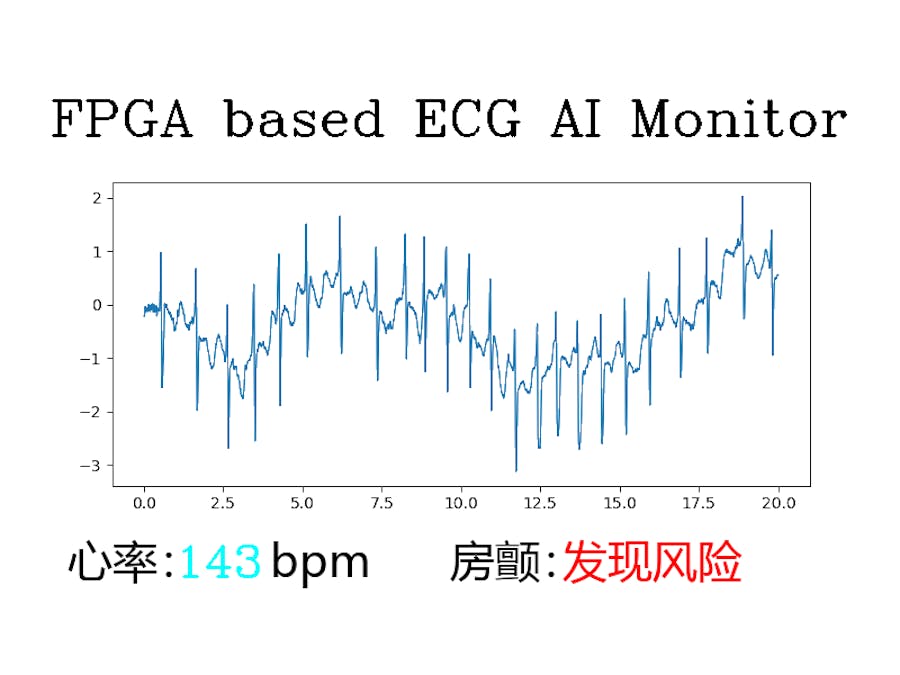 Ultra96_for_medical_care