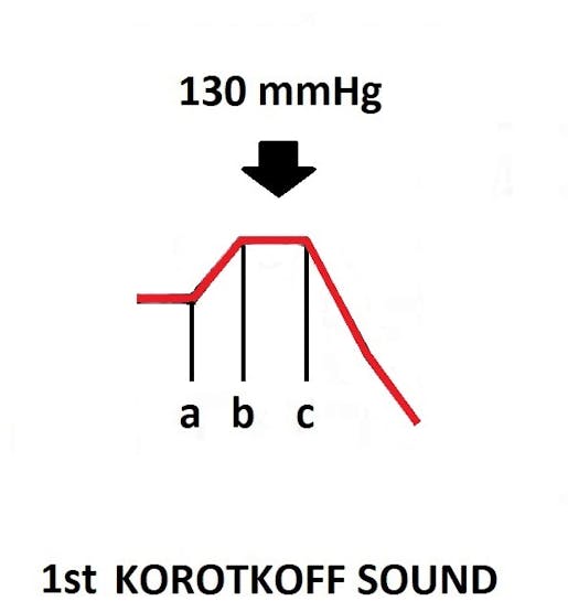 130 mmHg > 129 mmHg and 130 mmHg > 129 mmHg