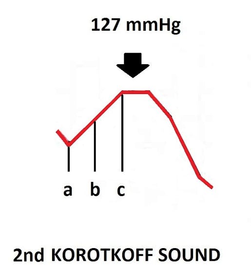 126 mmHg > 125 mmHg and 127 mmHg > 125 mmHg