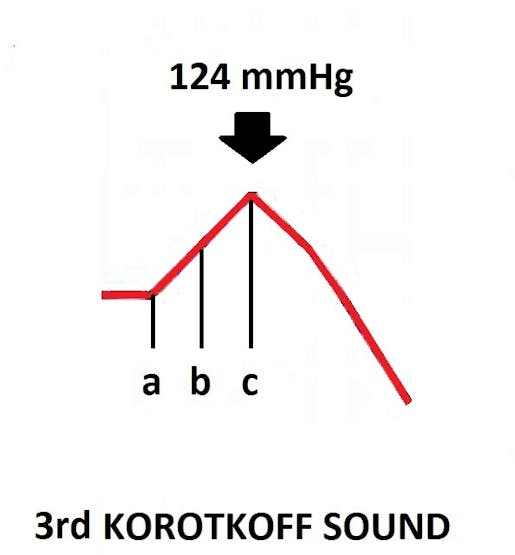 123 mmHg > 122 mmHg and 124 mmHg > 122 mmHg
