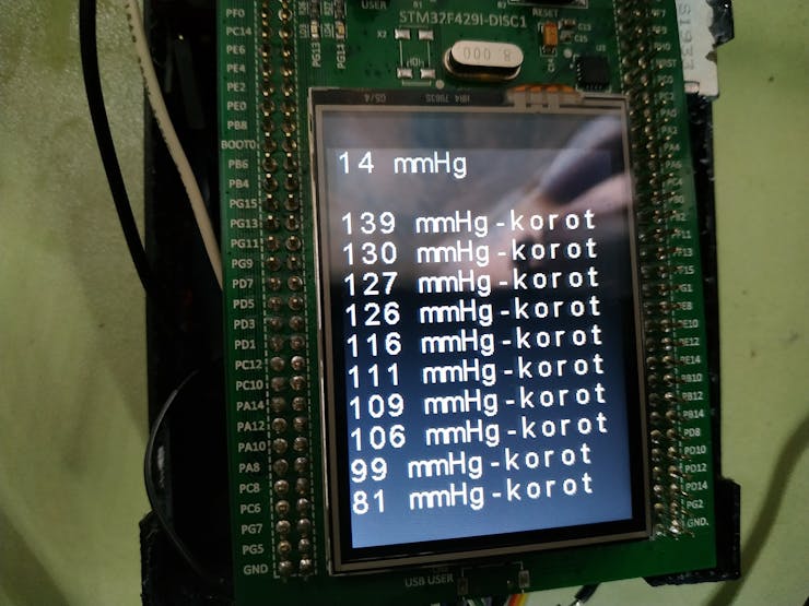 Ten Korotkoff sounds