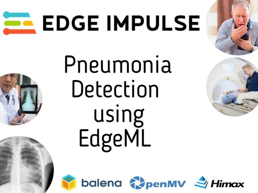 Pneumonia Classification & Detection Using EdgeML