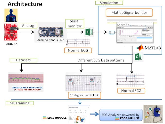 ECG Analyzer Powered by Edge Impulse - Arduino Project Hub