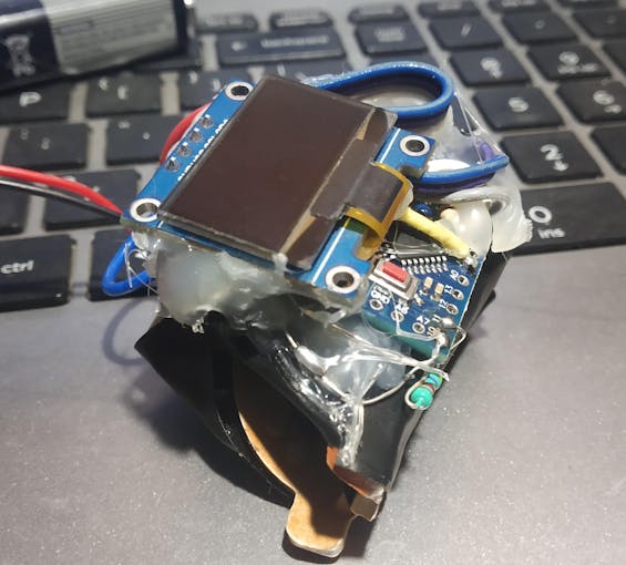 DIY Pulse Oximeter Arduino Project Hub