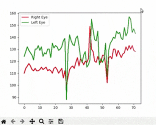 eye_wink_histogram.gif eye_wink_histogram.gif