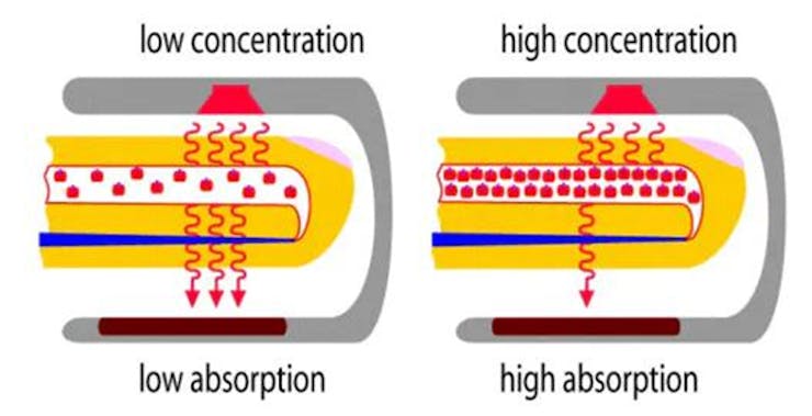 Photoplethysmography