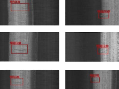 Metal surface defect detection based on Xilinx kv260