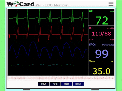 WiFi ECG Monitor - ESP and MAX30100 (heart-rate, oximeter)