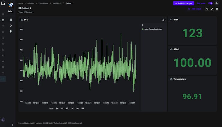 Live data of the patient1