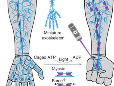 Neural network integrated Hydrogel-based exoskeleton