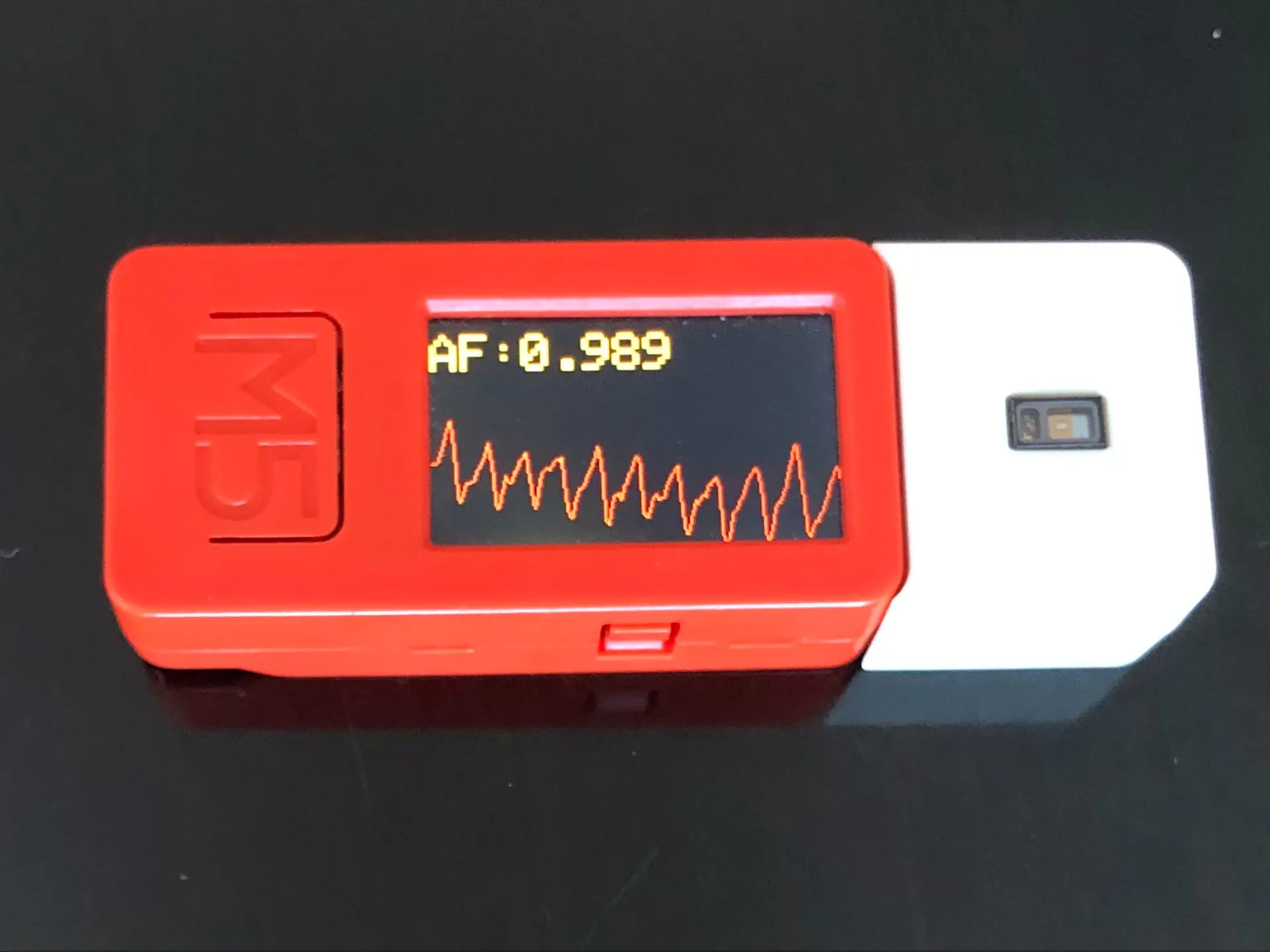 Detecting Atrial Fibrillation using Photoplethysmography - Hackster.io