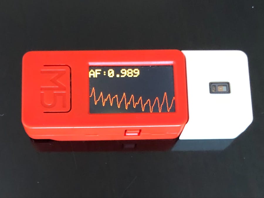 Detecting Atrial Fibrillation using Photoplethysmography