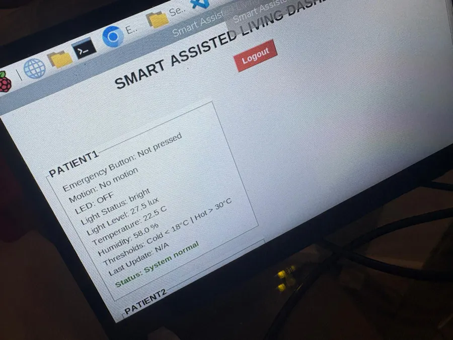 Remote Patient Monitoring and Alert System