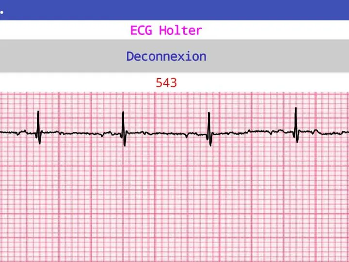 A low-cost, ultra-reliable Holter ECG monitor