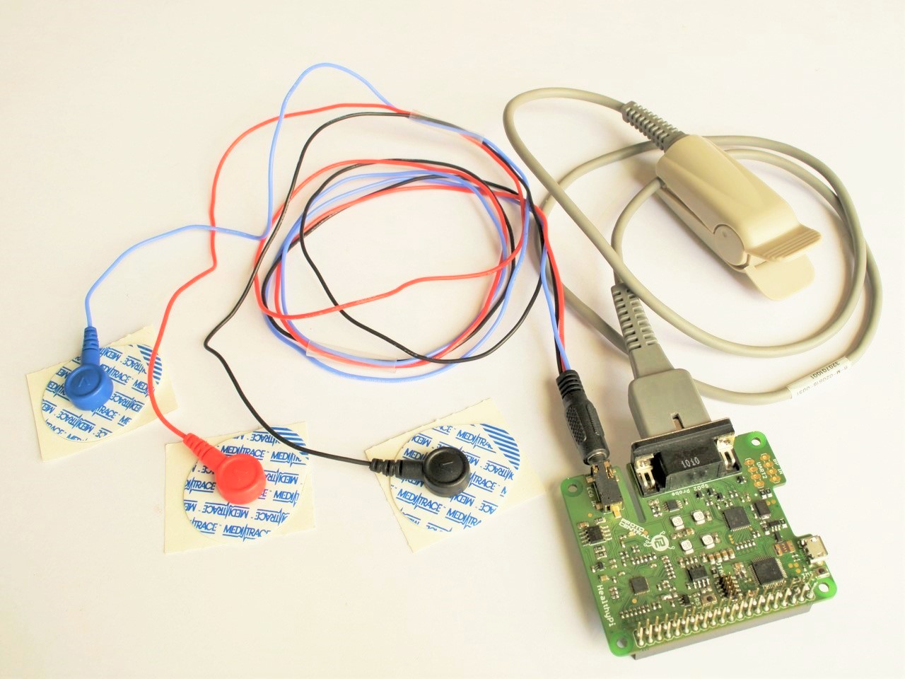 raspberry pi ecg monitor