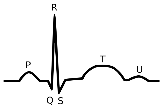 Single-lead ECG & Heartrate Variability using MAX30003 - Arduino ...