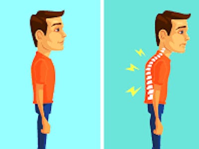Spinal Cord Posture Monitoring