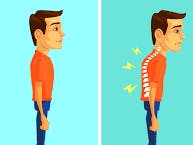 Spinal Cord Posture Monitoring