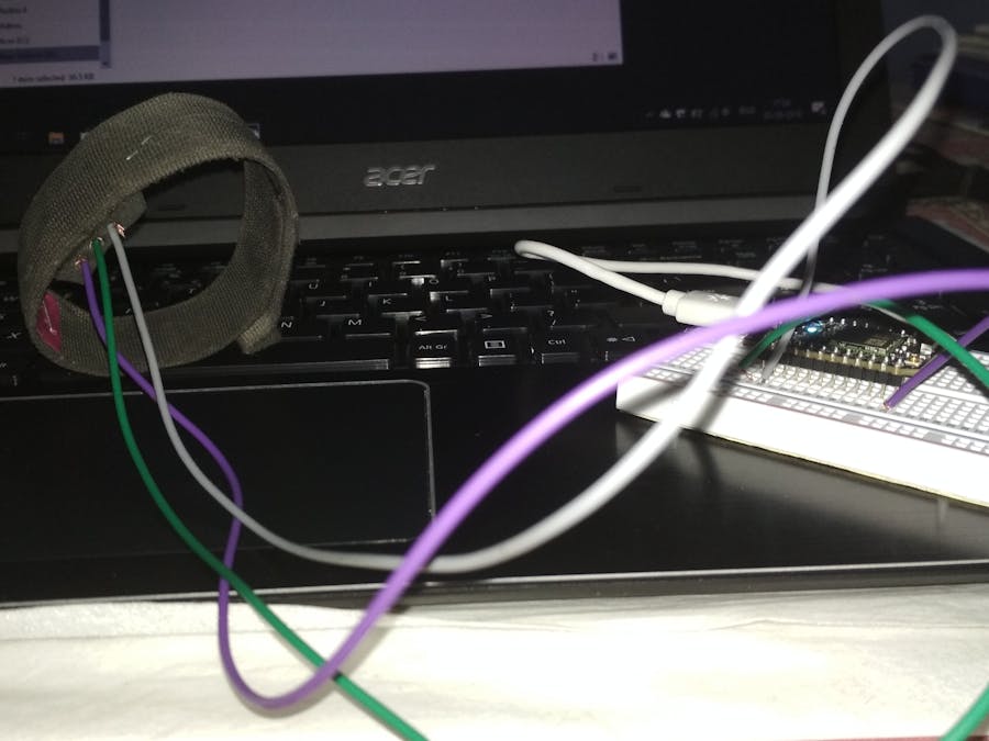 Heartbeat Abnormality Informer