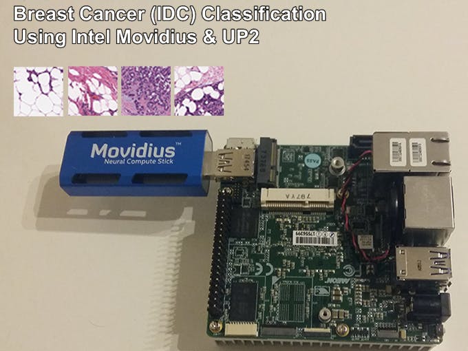 Breast Cancer Classification Using Movidius & UP2