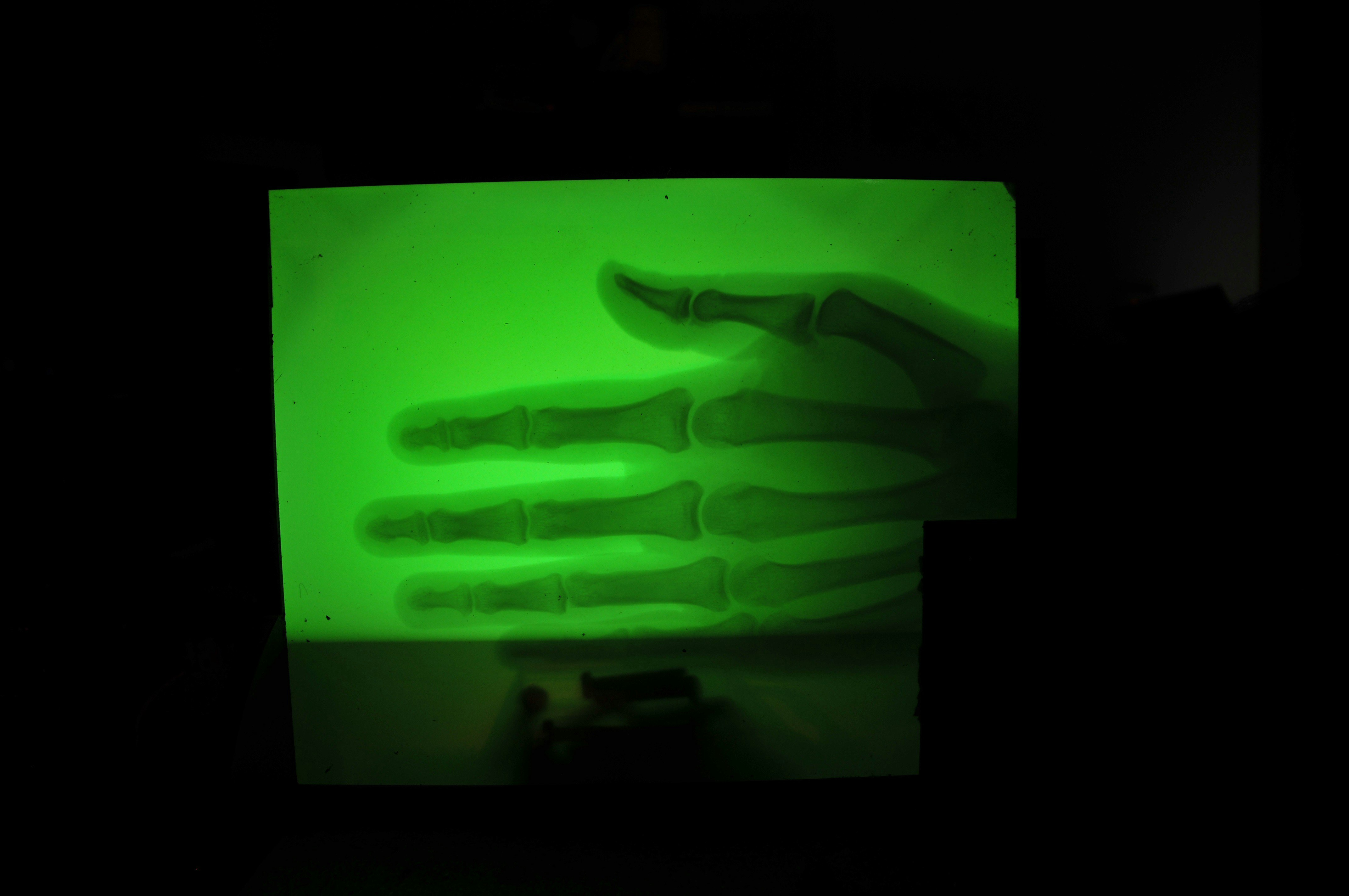 A Diy X Ray Machine Yes A Diy X Ray Machine Hackster Io A Diy X Ray Machine Yes A Diy X Ray Machine Hackster Io