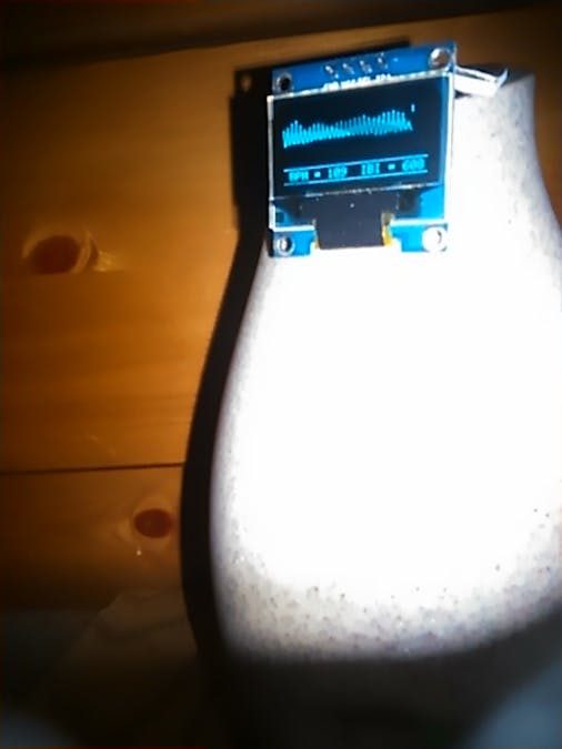 Wireless Heart Monitor