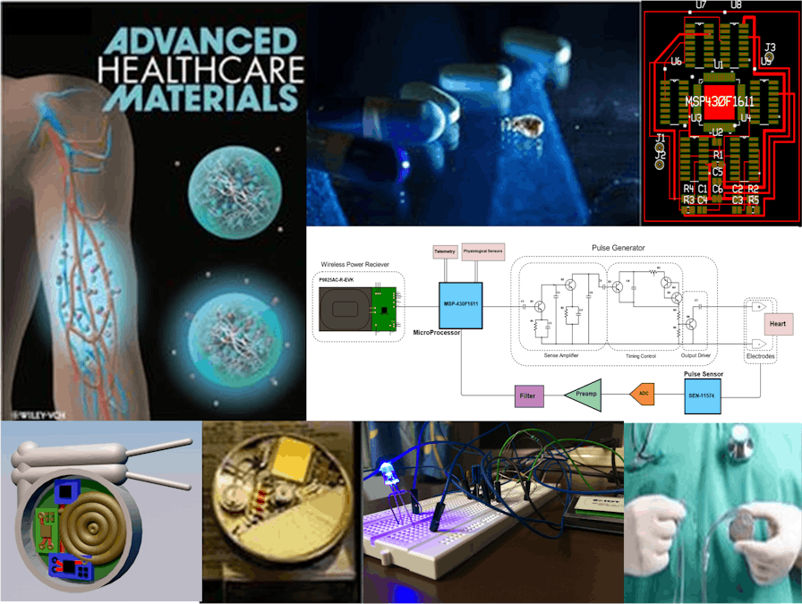 Pacemaker with Wireless Charging Capabilities