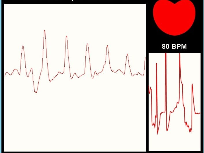 E-Health: Low Cost Sensors for Early Disease Detection