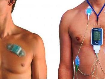 Arduino WiFi Pulse Monitor