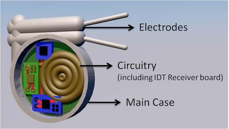 Pacemaker%20Enclosure%20Diagram.png