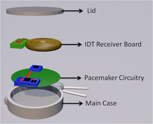 Pacemaker with Wireless Charging Capabilities - Hackster.io